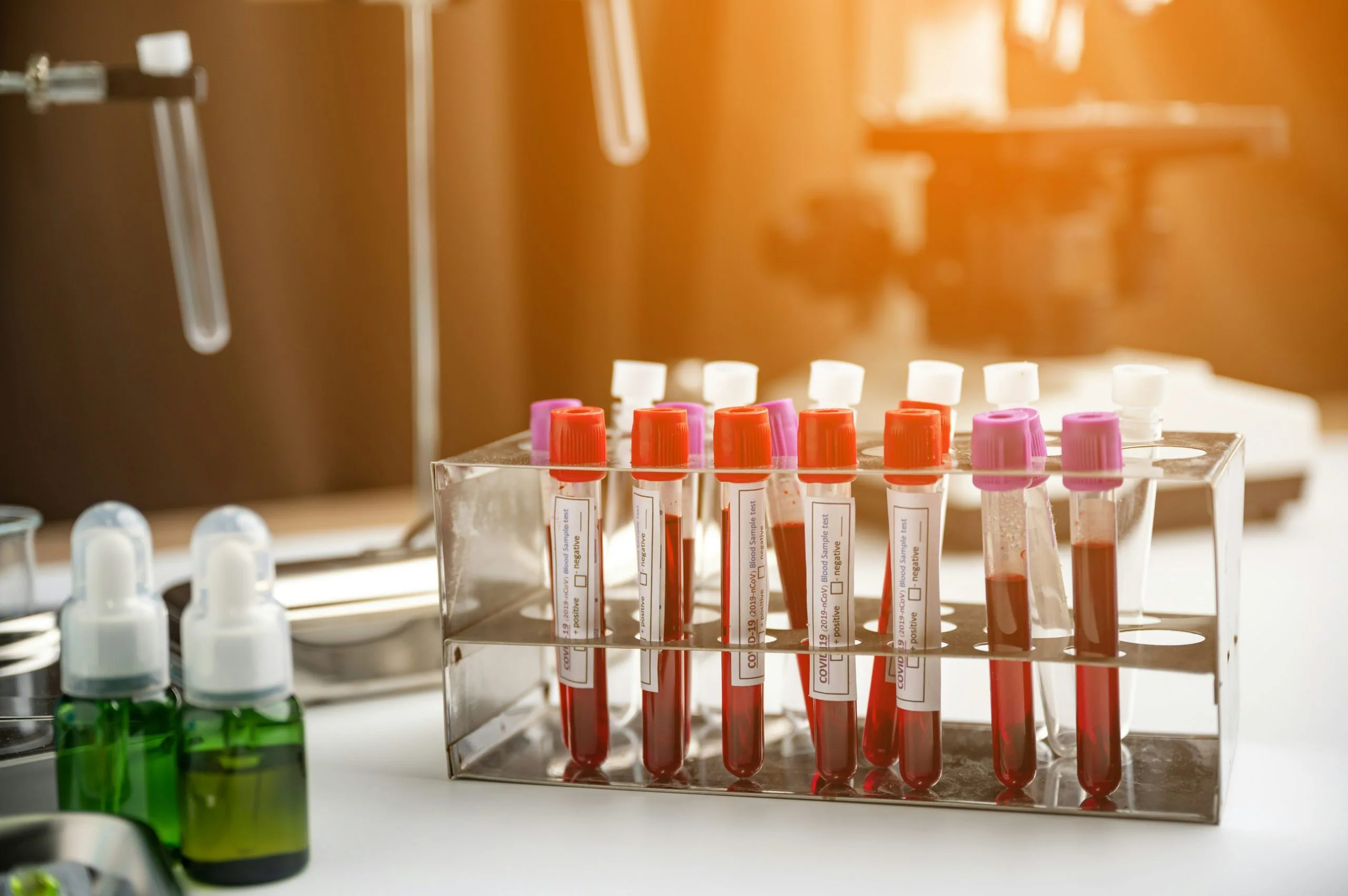 Laboratory blood sample tubes in a clinical lab setting